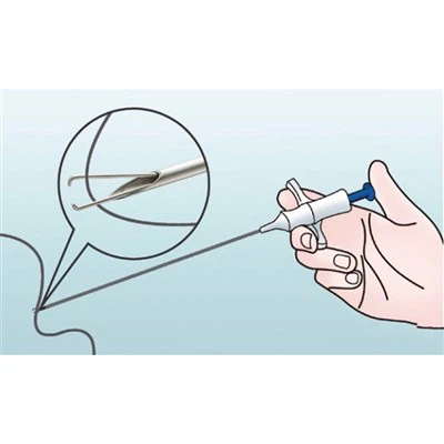 עובר תפר לפרוסקופי